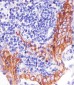 PD L1 Monoclonal  Antibody (PDL1)